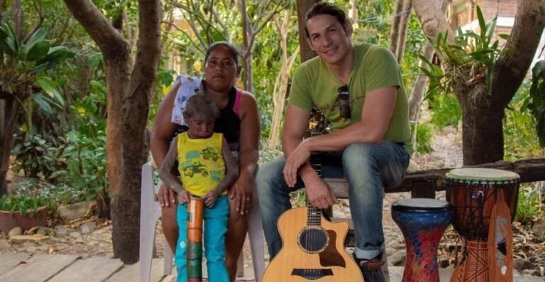 Realizarán concierto a beneficio de niña con rara enfermedad en la piel