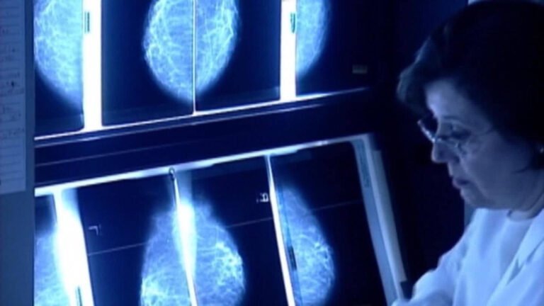 Muertes por cáncer en EEUU disminuyeron en los 25 últimos años pero persiste brecha entre ricos y pobres, según estudio