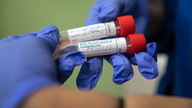 Confirman primer caso de reinfección de COVID-19 en EEUU