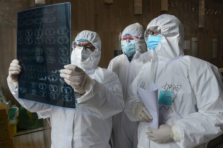 Estudio encuentra altas tasas de daño hepático entre pacientes con coronavirus