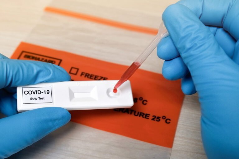 Pruebas de anticuerpos contra coronavirus disponibles para público