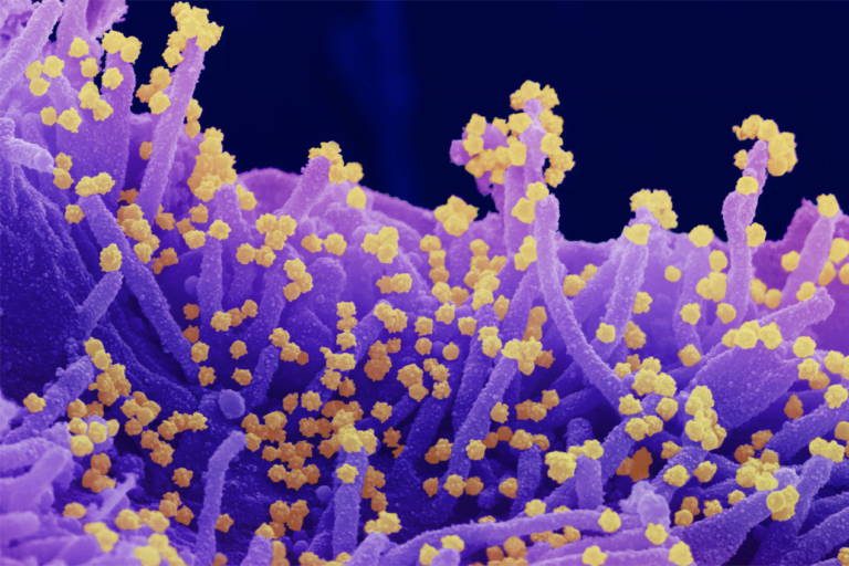 Las misteriosas mutaciones que hacen de delta la variante del virus de COVID más contagiosa hasta ahora