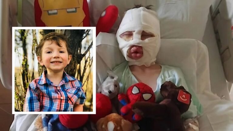 Policía de CT asegura que menor no fue quemado por otros niños