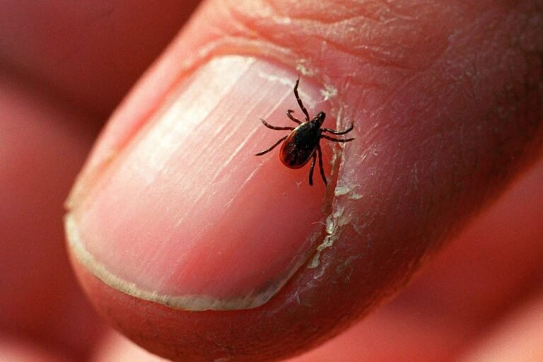 Mujer de CT muere de virus Powassan