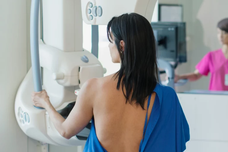 ¿Mamografías a los 40? Nueva pauta para la detección del cáncer de seno genera debate