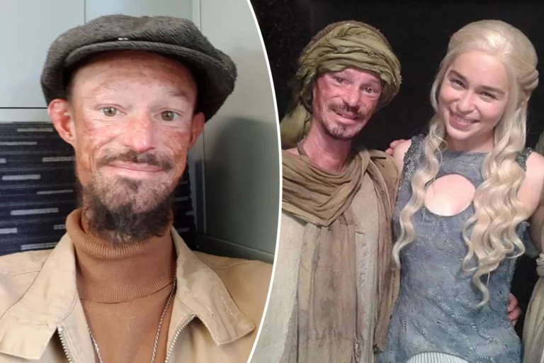 Muere Darren Kent, actor de ‘Game of Thrones’, a los 39 años