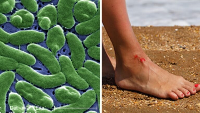 Dos personas mueren por infección bacteriana grave