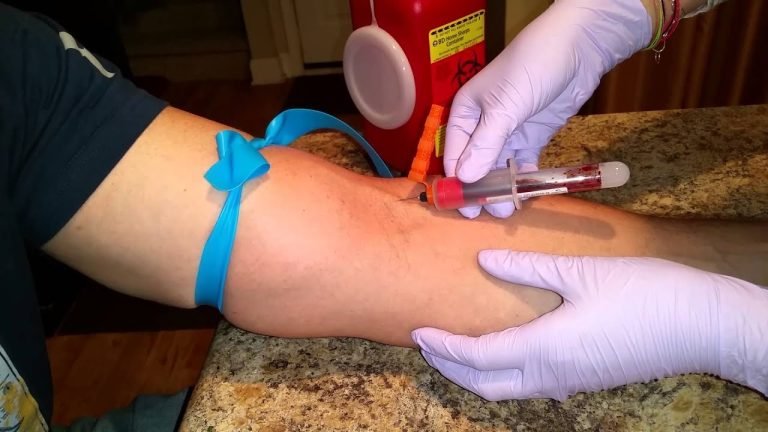 Capacitan a policías sobre cómo extraer sangre