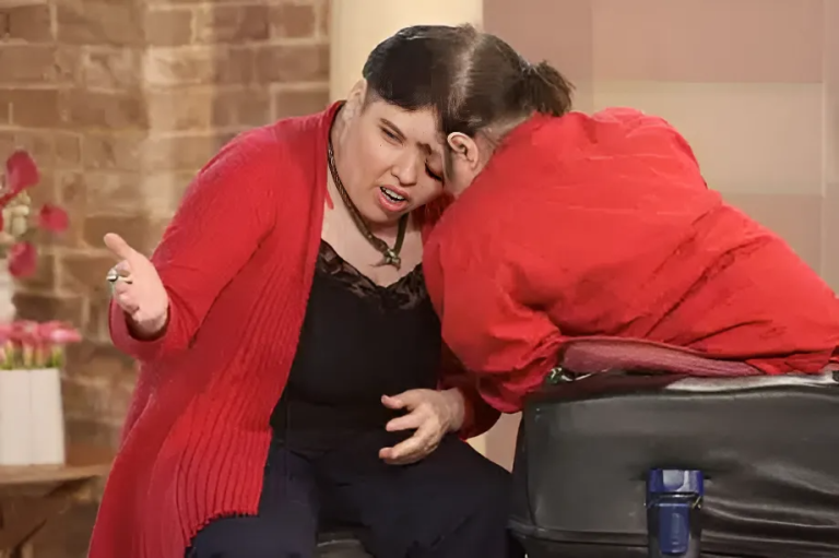 Murieron Lori y George, siameses de 62 años que hicieron historia